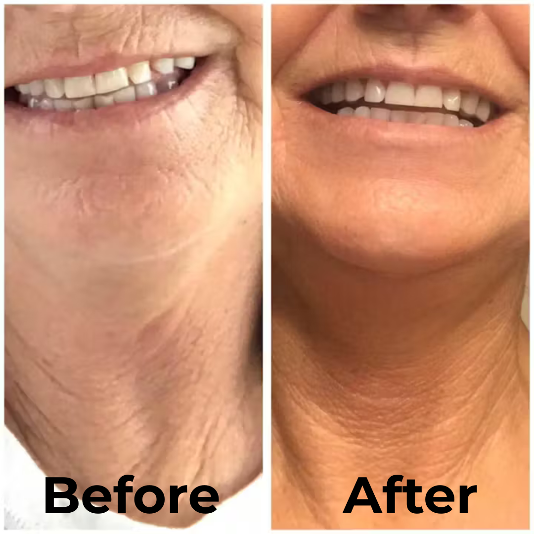 Crepey Skin Repair Body Lotion (Urea + Hyaluronic + Ceramides)