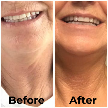 Crepey Skin Repair Body Lotion (Urea + Hyaluronic + Ceramides)