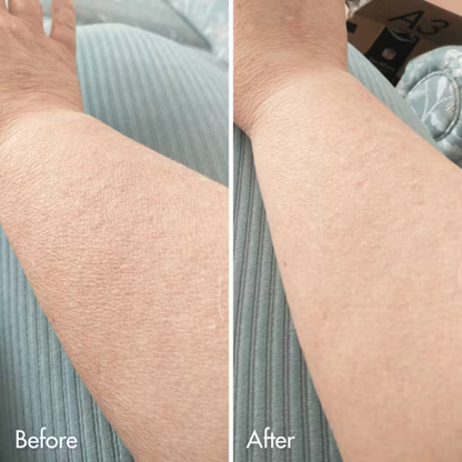 Crepey Skin Repair Body Lotion (Urea + Hyaluronic + Ceramides)